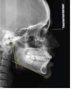 placa cabeza